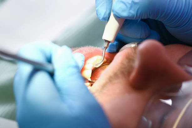 Best Emergency Dentist for Knocked-Out Tooth in Tyler, TX