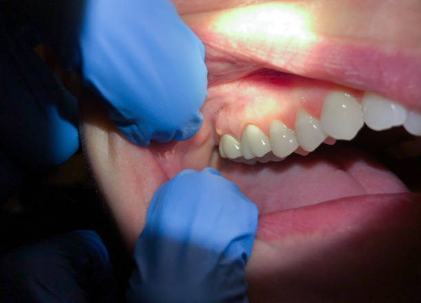 Best Emergency Cosmetic Dentistry in Tyler, TX